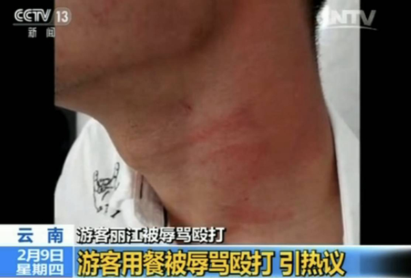 游客麗江就餐被辱罵毆打 真相到底是什么？